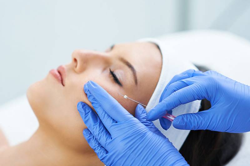 Woman receives facial thread lifting through professional wellness treatment at the Arkona Strandhotel in Binz on Rügen.