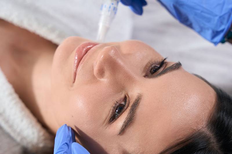 Close-up of a microneedling application on the face with DERMA PEN by ÄsthetikaMed in the Arkona Strandhotel on Rügen.