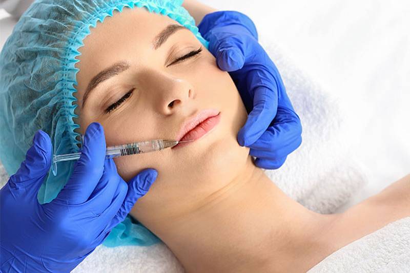 Woman receives hyaluronic filler on her lips through professional application by ÄsthetikaMed at the Arkona Strandhotel on Rügen.